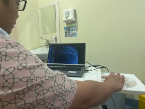 doktor tunjuk saluran darah kat jantung selepas angioplasty